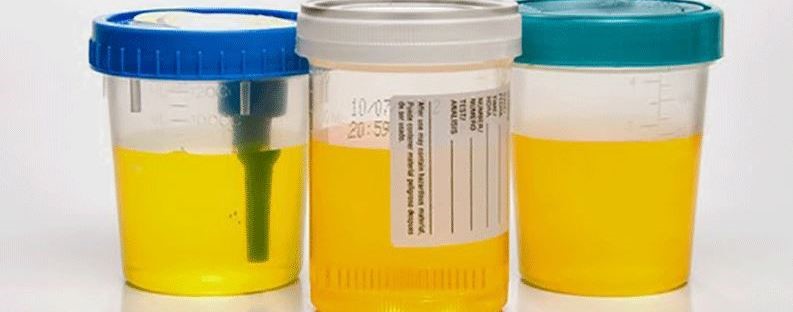 Synthetic Urine 
      Temperature Strips Upper Madison Bridgeport CT